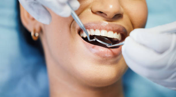 Best Dental Abscess Treatment in Franklin, PA