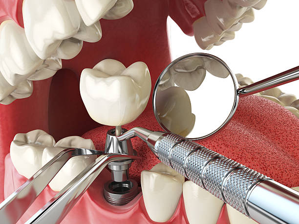Best Emergency Treatment for Jaw Pain or Injury in Franklin, PA